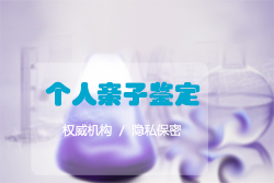 石家庄血缘检测迁户麻烦么,石家庄用亲子鉴定上户口办理的条件 石家庄血缘检测迁户麻烦么,石家庄用亲子鉴定上户口办理的条件