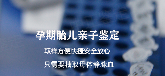 怀孕了石家庄如何做孕期亲子鉴定,石家庄做孕期亲子鉴定结果准确吗 怀孕了石家庄如何做孕期亲子鉴定,石家庄做孕期亲子鉴定结果准确吗